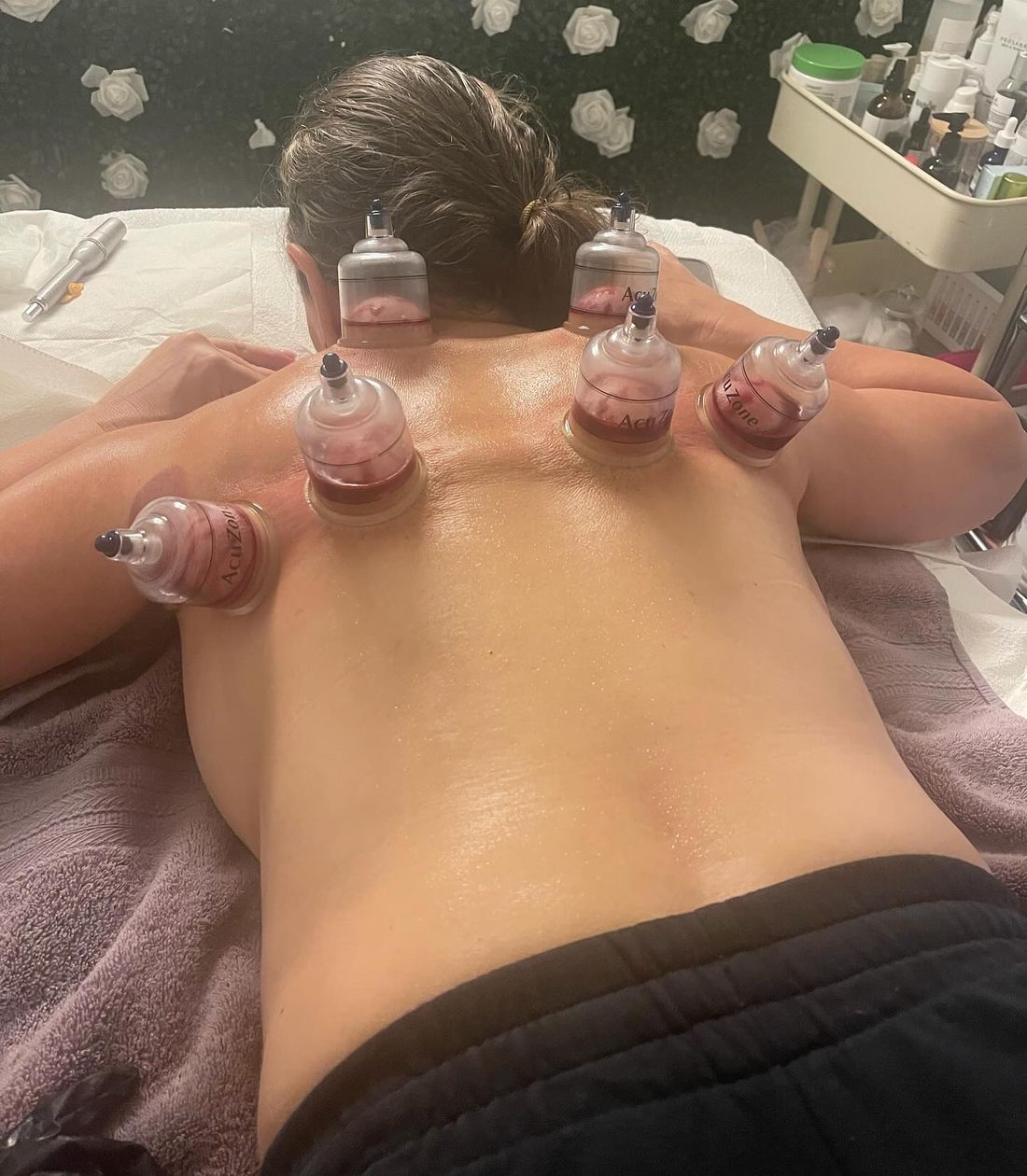 Glass cups on a client's back in front of Elena's white rose wall